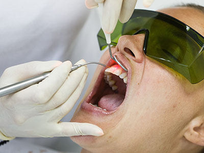 Blue Island Smiles | Implant Restorations, Fluoride Treatment and All-on-6