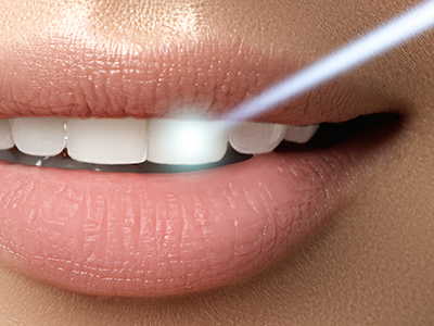 Blue Island Smiles | TMJ Disorders, Extractions and Implant Dentistry